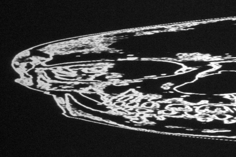 Λεπτομέρειες